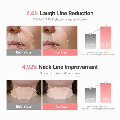 PDRN Collagen Wrinkle Balm Stick